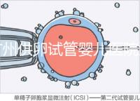 廣州供卵試管嬰兒醫(yī)院匯總，真實(shí)案例告訴你廣東哪家最好